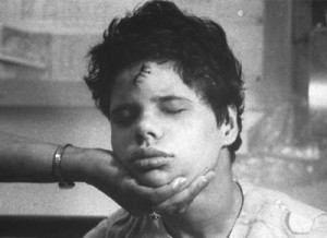 Young man with large, poorly stitched head wound, circa 1970s